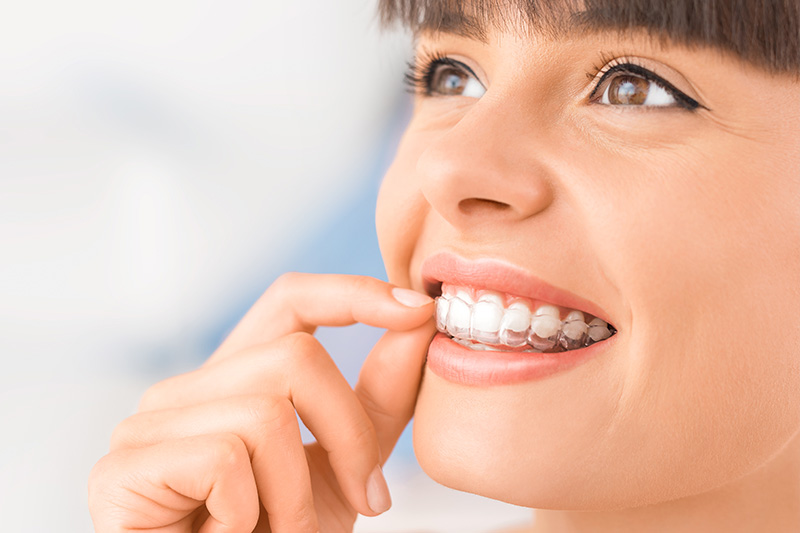 Capital City Smiles Special Offer