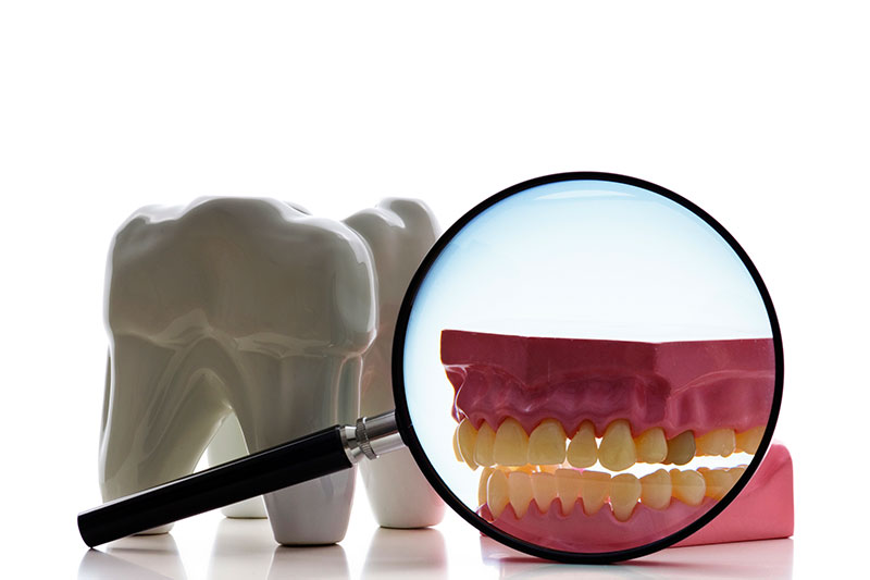 Root Canals in Austin