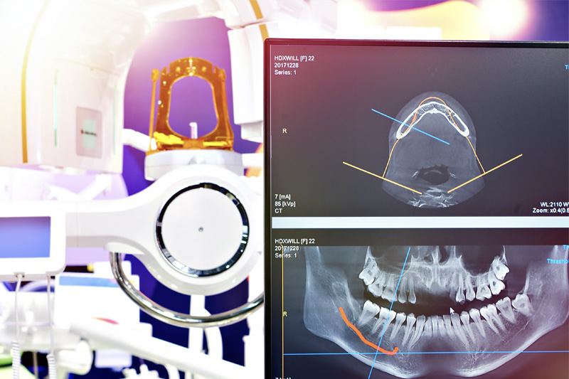Digital X-Rays in Austin
