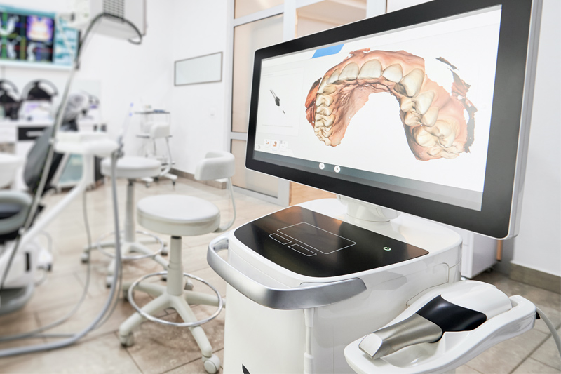 Intra-Oral Scanner in Austin